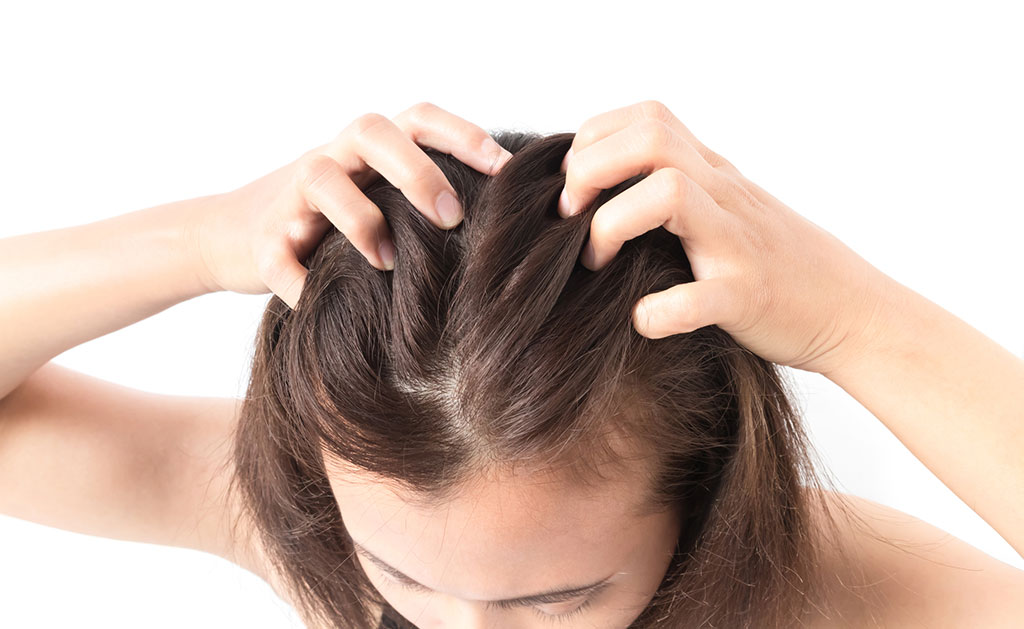 How can you treat hair loss for women?